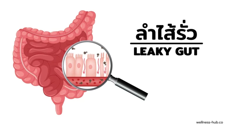 ลำไส้รั่ว Leaky Gut | อาการ-สาเหตุ-รักษา-ป้องกัน